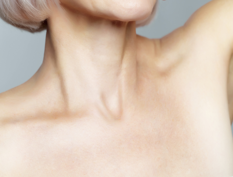 Wrinkled & Crepey Décolletage